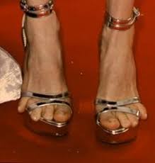 Ugly feet on Pinterest | Celebrity Feet, Toe Nails and Toenails via Relatably.com