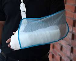 Image of person wearing a sling after shoulder surgery