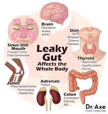 Image result for leaky gut