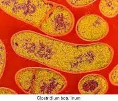 نتيجة بحث الصور عن ‪clostridium botulinum‬‏