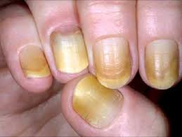 Resultado de imagen de uñas de las manos