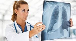 Image result for paru-paru berlendir