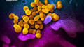 coronavirus symptoms from www.wtvr.com