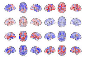 How Rare Genetic Variations are Linked to Cardiovascular Risk: Insights from Brain Signatures