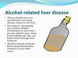 Image result for cirrhosis of liver symptoms