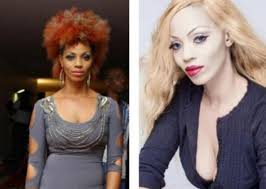 Image result for skin bleaching pictures before and after